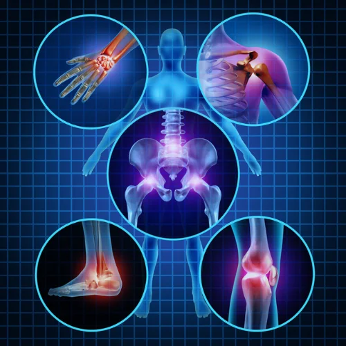 poly-arthrities