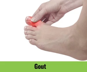 gout