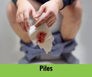 piles