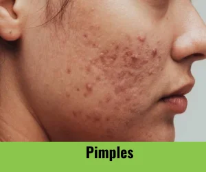 pimples